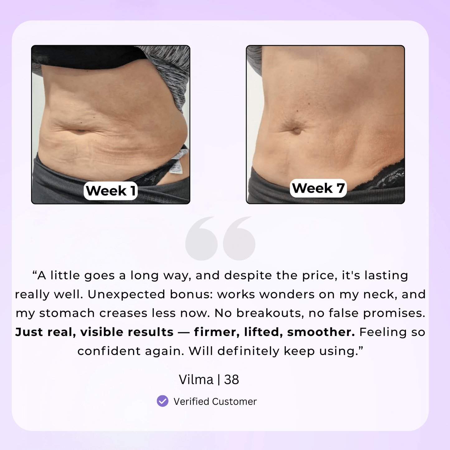 Soothen & Tighten Belly Cream