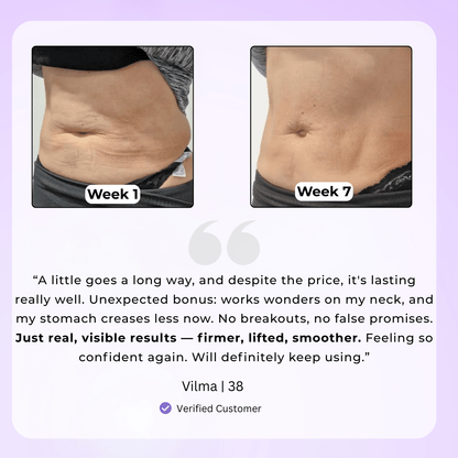 Soothen & Tighten Belly Cream